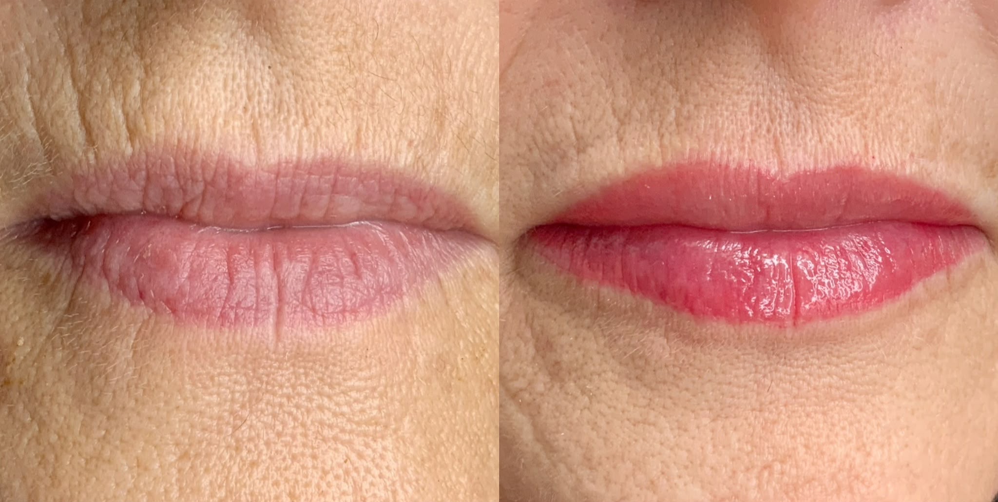 before and after of lip hydration