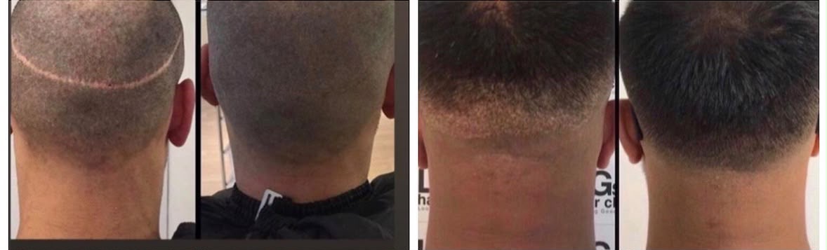 before and after men's hair treatments