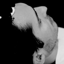 Hairloss_By-Jade-Weybridge-3_bw_by jade treatments men hairloss treatment
